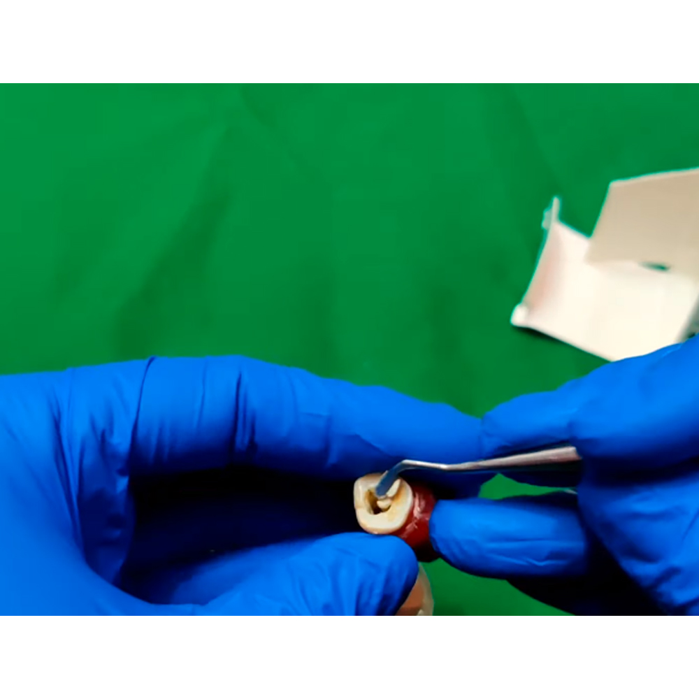 3M ESPE Cavit -G Temporary Filling Material