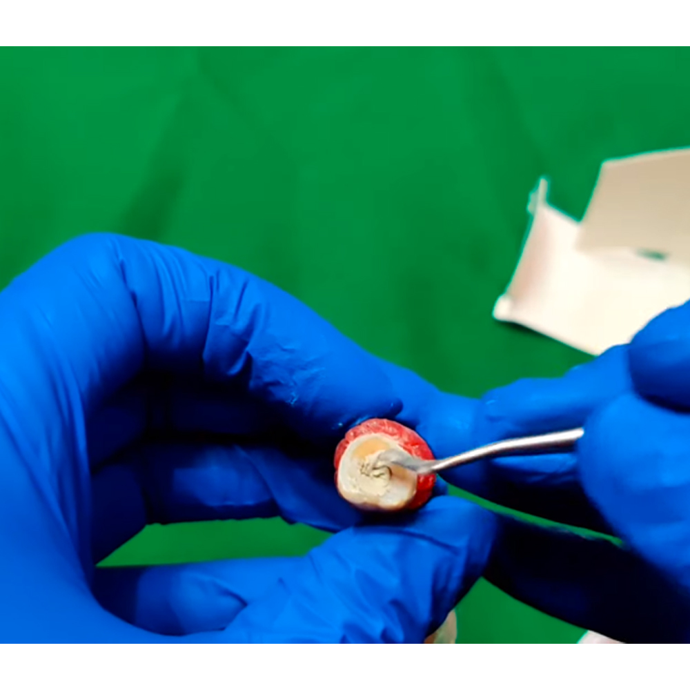 3M ESPE Cavit -G Temporary Filling Material