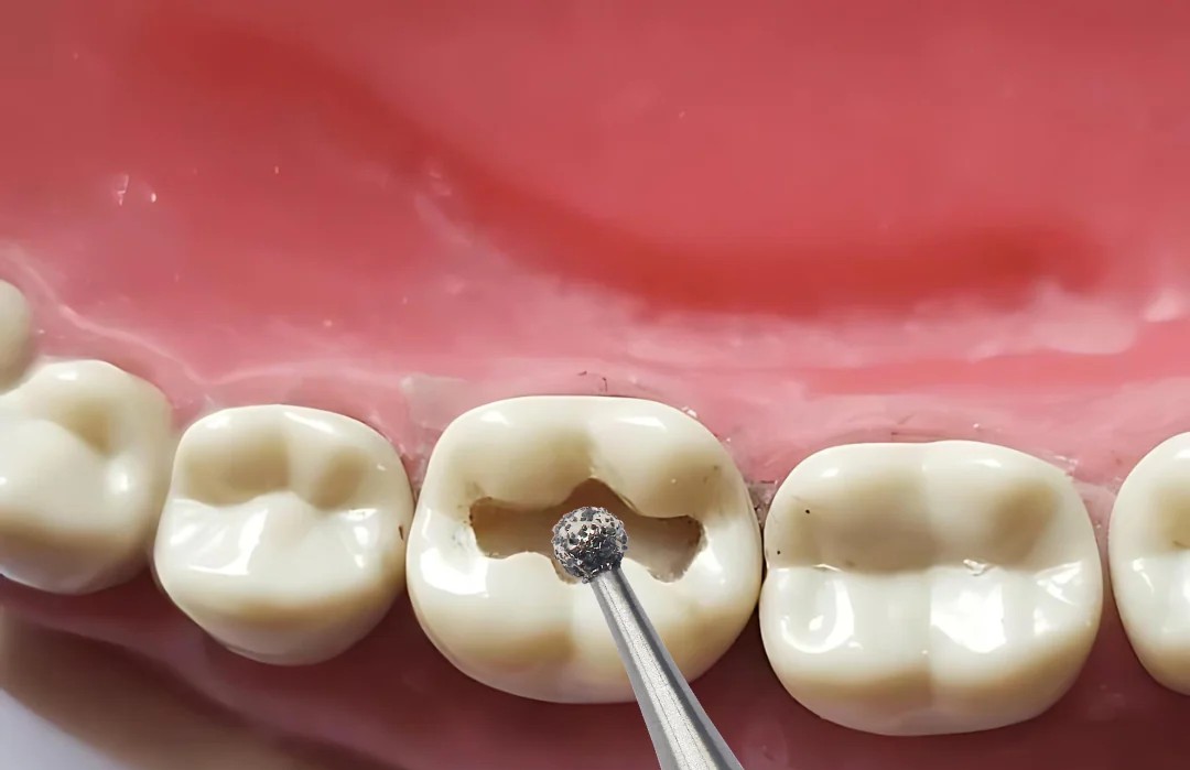 Frank Dental Round Diamond Burs BR Series (Regular) 