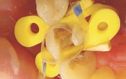 Tor Vm Transparent Sectional Contoured Matrices - 11
