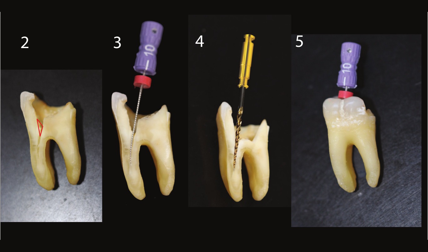 Mani Flare Files 21mm