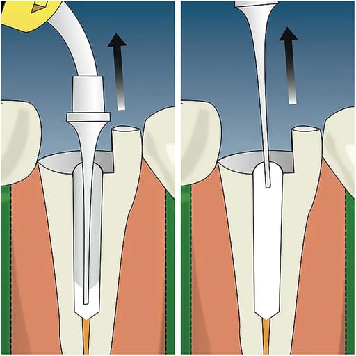 Cerkamed Calcipast Calcium Hydroxide Paste (Radiopaque)
