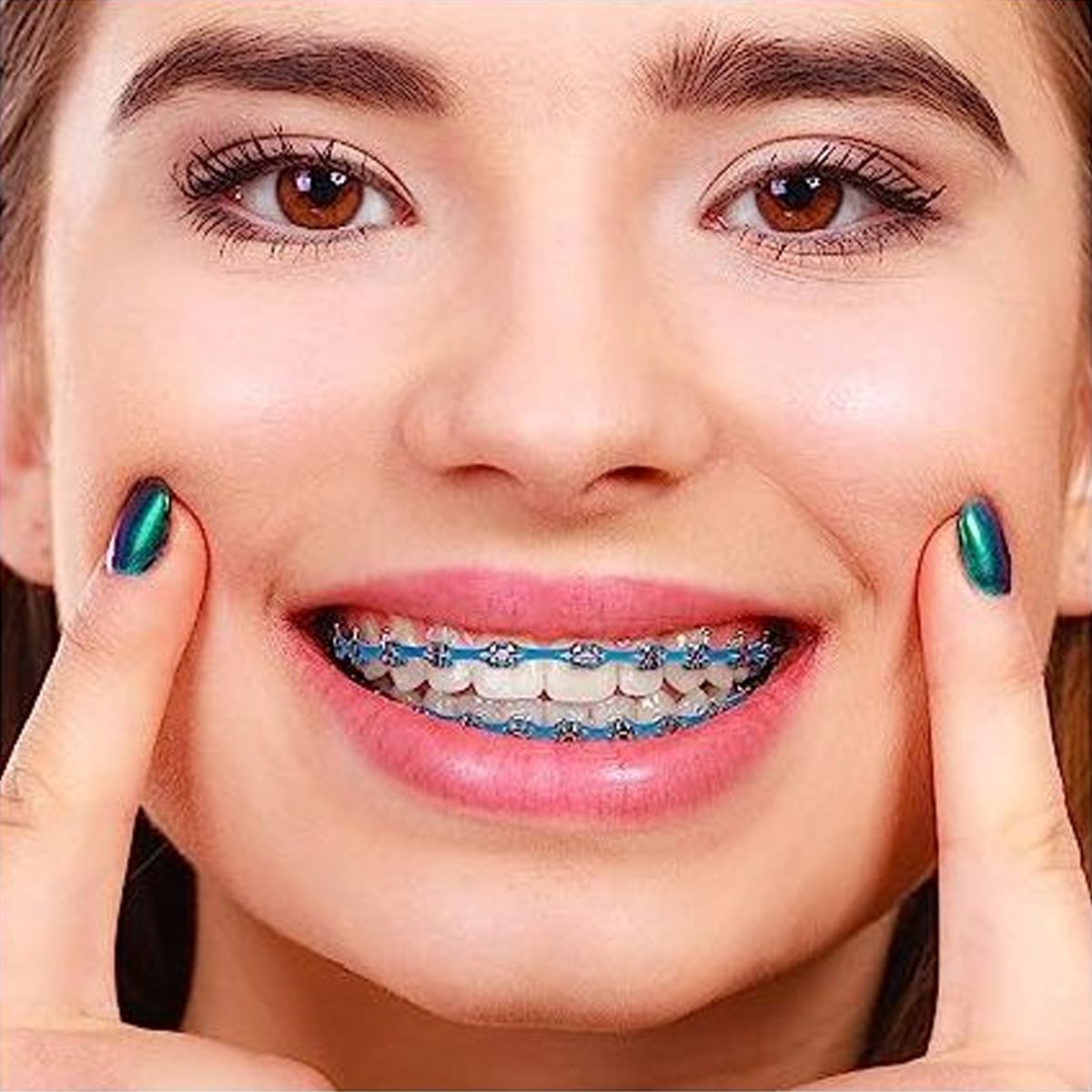 OrthoMetric E-Chains 15 Ft