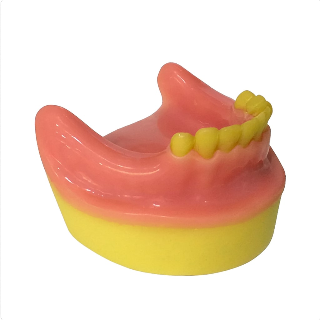 Dental Model Partially Edentulous Mandible MD-123
