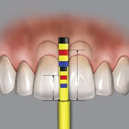 Hu-Friedy Chu'S Crown Lengthening Gauge (CLG) - 5