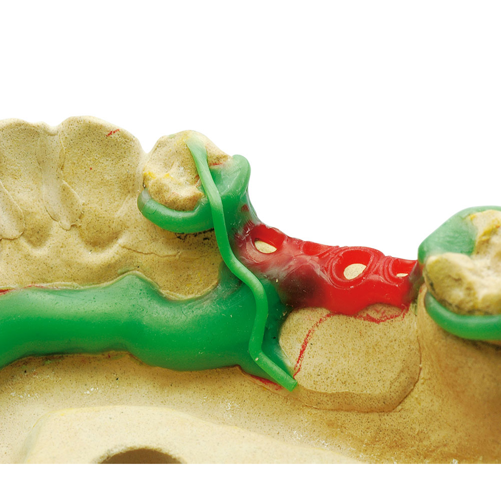 Maarc Clasp Profile Waxes (2907/010)