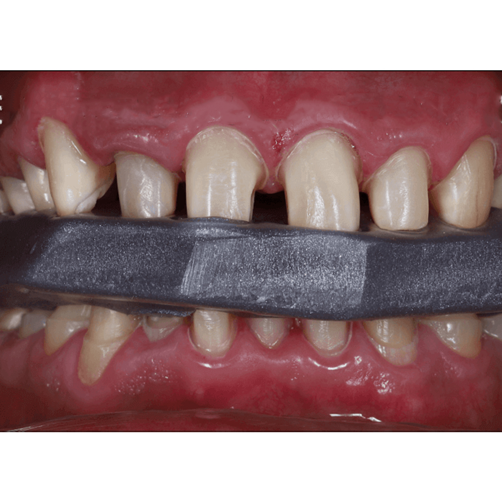 Maarc Classic Bite Registration Wax Extra Hard (2207/010)