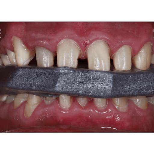 Maarc Classic Bite Registration Wax Extra Hard (2207/010)