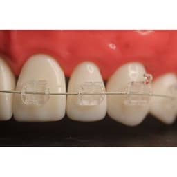 Koden Clear HD MBT Bracket Kits - 5