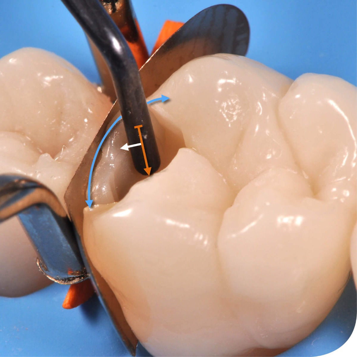 GDC Filling Instruments Set Of 12 Instruments Kit (FIS12)