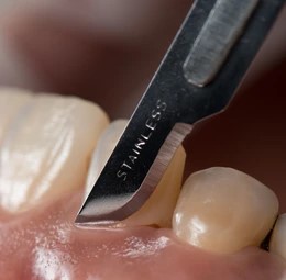 Pioneer Sterile Surgical Blades (Pack of 100)