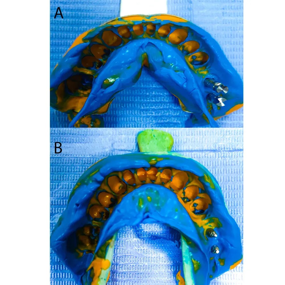 Adin RS Closed Tray Transfer