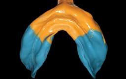 Waldent Edentulous Perforated Impression Trays Set K18/1 - 9