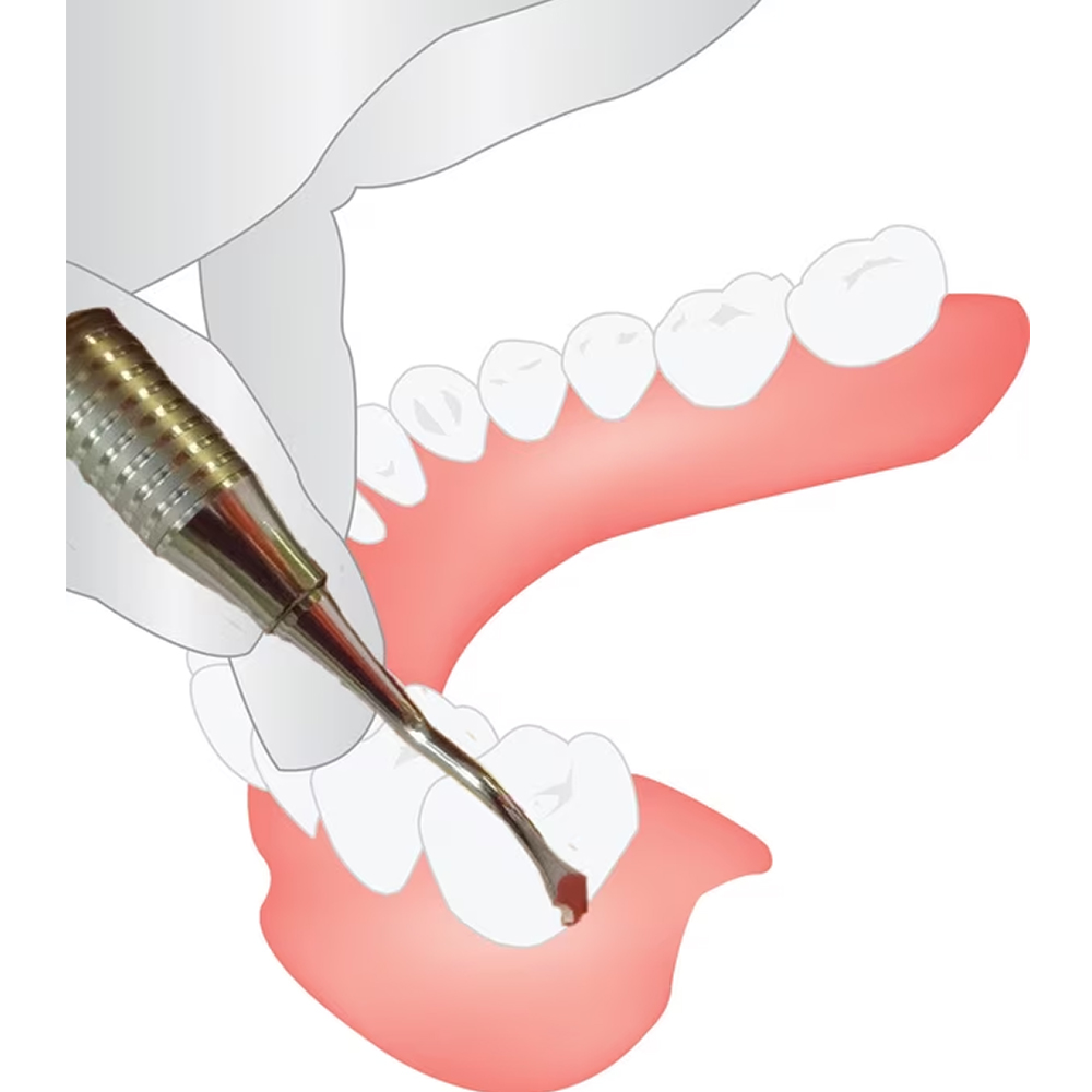 GDC Ochsenbein Chisel - 4 # 6 (CO4)