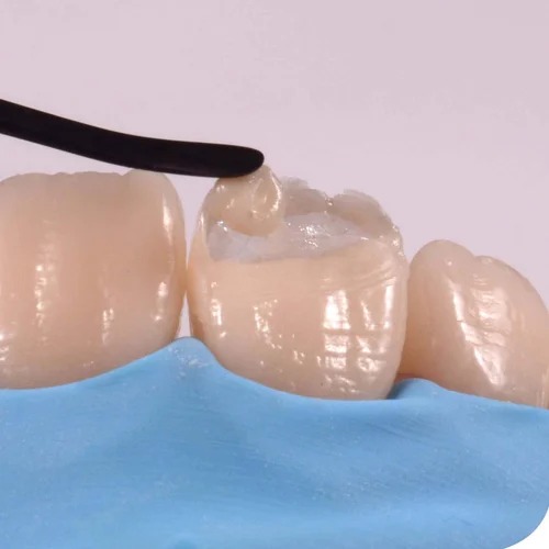 GDC Plasma Coated Black Composite Posterior Medium / Large Contact (TNCFIM/L)