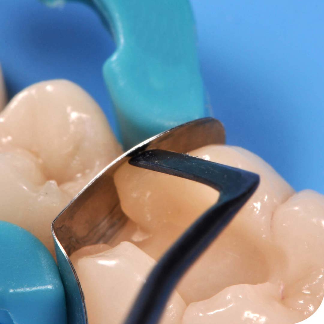 GDC Composite Instrument Blue Titanium - 6 (CIB6)