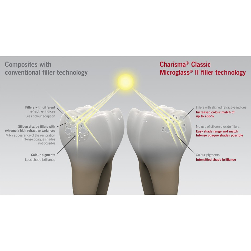 Kulzer Charisma Classic Composite Restorative Kit- With Gluma Bond Universal