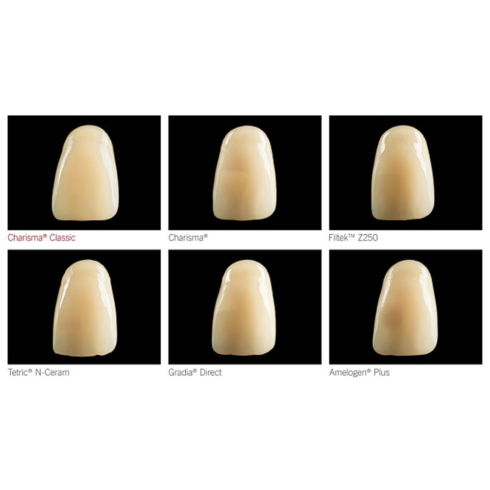 Kulzer Charisma Classic Composite Restorative Kit- With Gluma Bond Universal