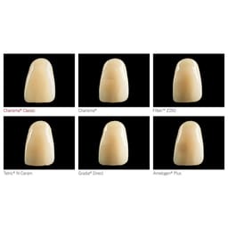 Kulzer Charisma Classic Composite Restorative Kit- With Gluma Bond Universal - 8