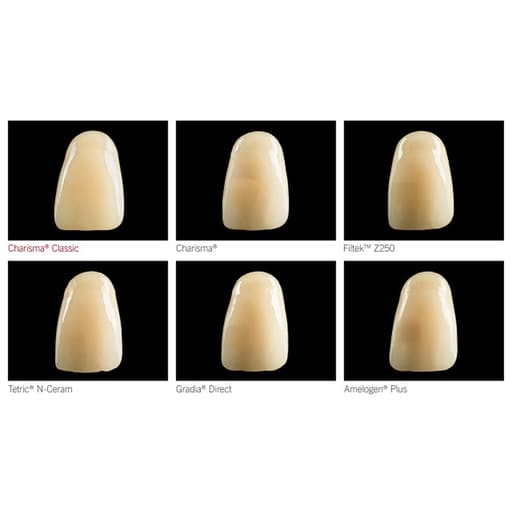 Kulzer Charisma Classic Composite Restorative Kit- With Gluma Bond Universal