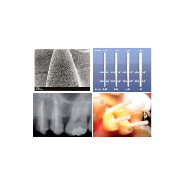 Hahnenkratt Contec Blanco Fiber Post