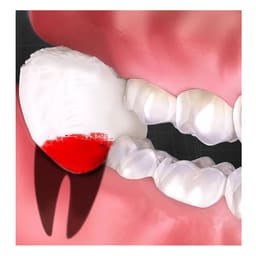 ET Dental Cotton Balls 300/pK - 3