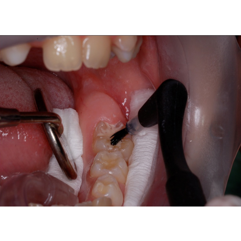 Oro Cotton Roll (Pack of 500 pc)