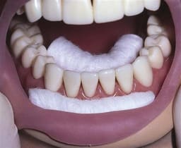 ET Dental Cotton Rolls (Pack of 1000pcs) - 8
