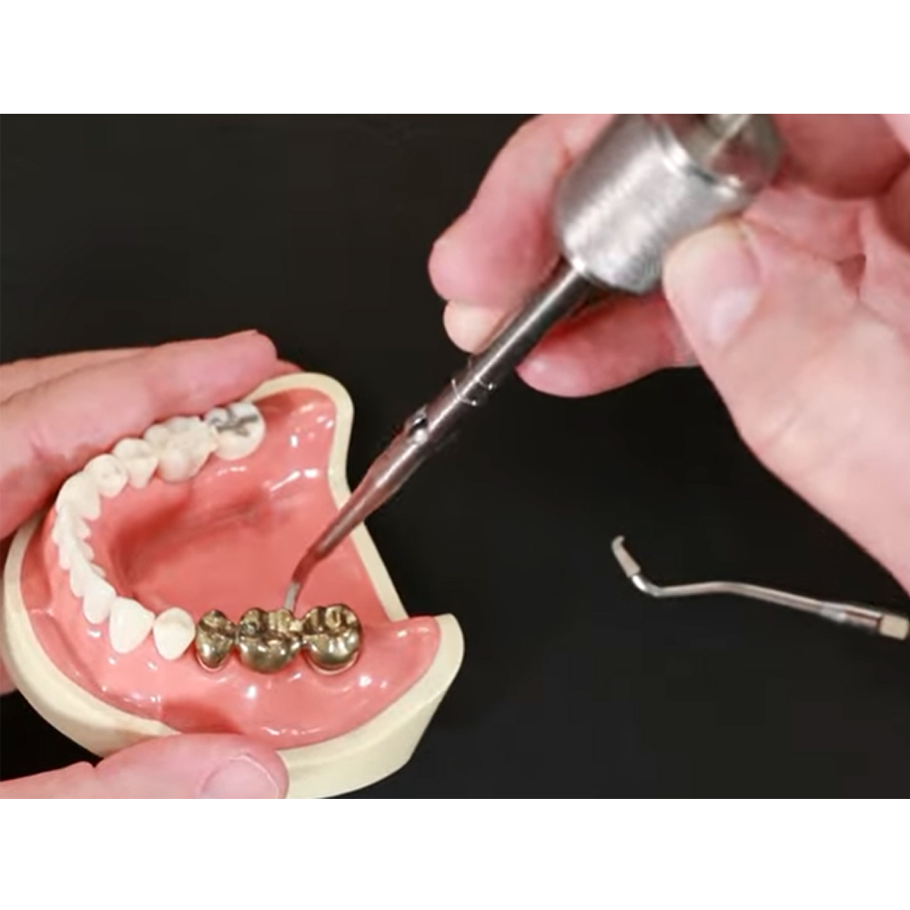 GDC Crown Remover Manual Pattern (CRMP)