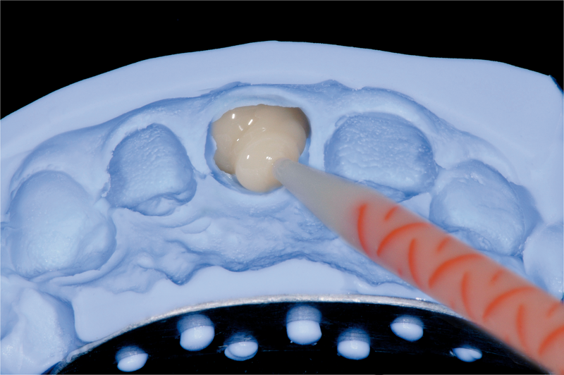 Cotisen Hp Mixing Tips