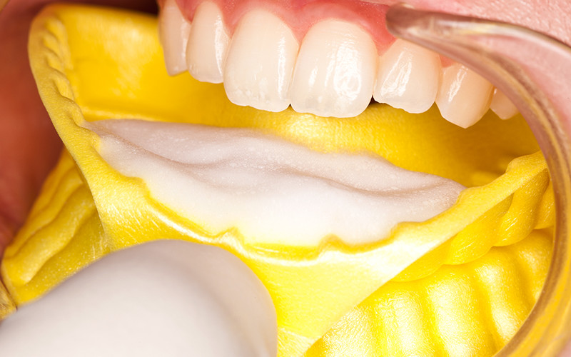 Cotisen Disposable Fluoride Foam Tray