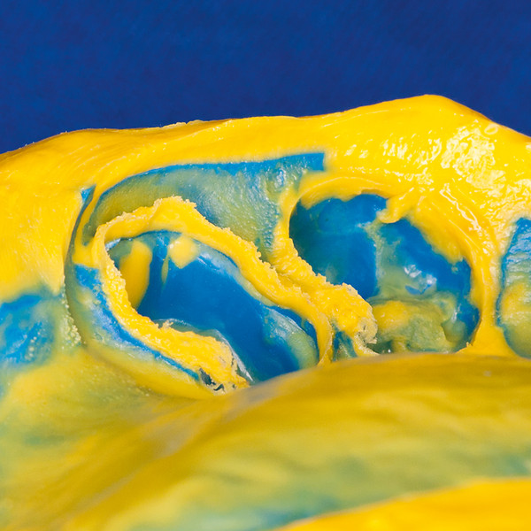 DMG Honigum Putty & Light Body