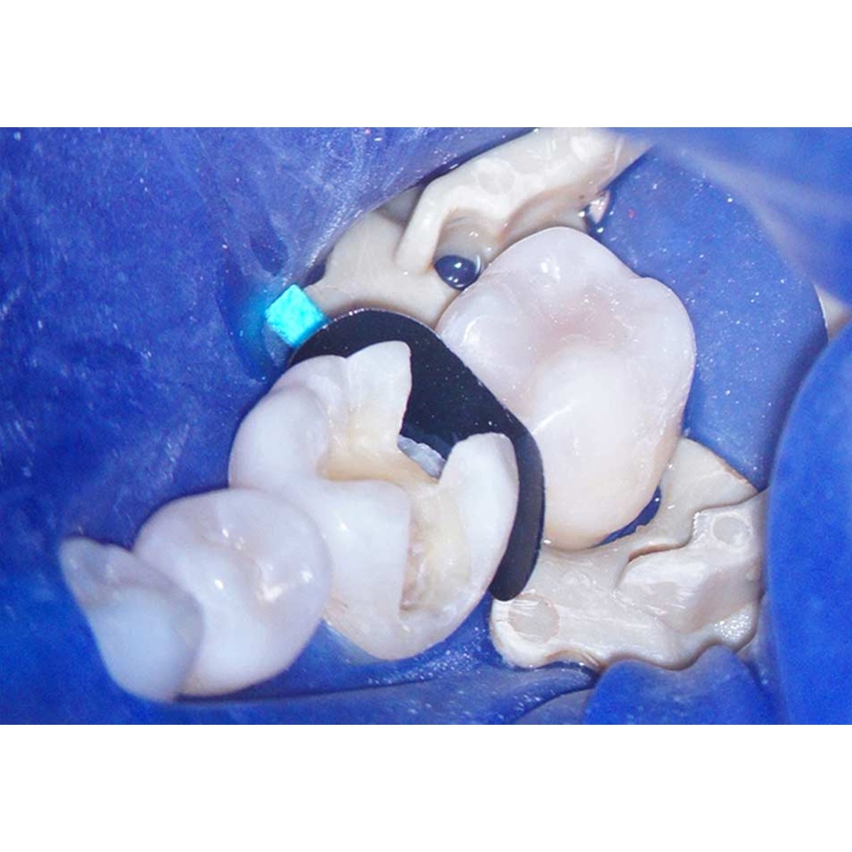 Polydential LumiContrast Sectional Matrices