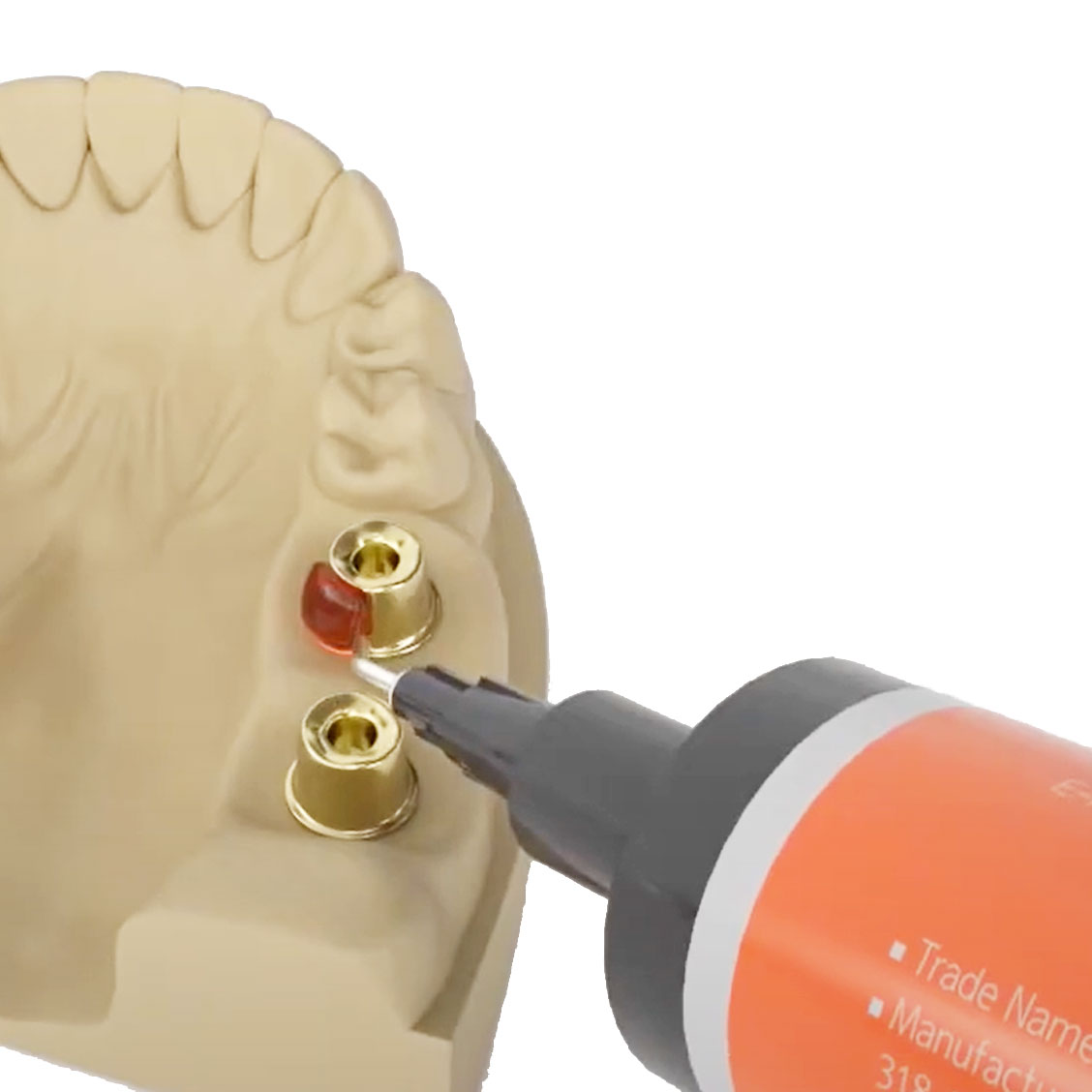 Alphadent EZ - Pattern LC For Dental Implant