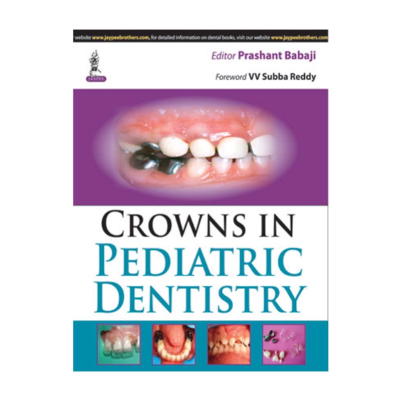 Jaypee Medical Crowns in Pediatric Dentistry (ISBN - 524397)