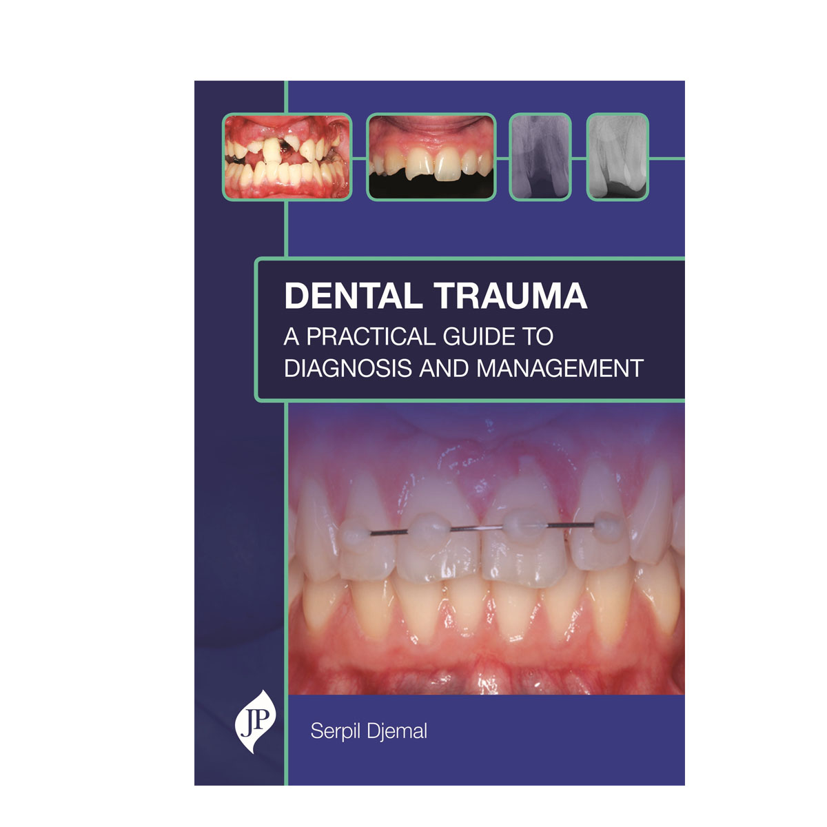 Jaypee Medical Dental Trauma: A Practical Guide to Diagnosis and Management (ISBN - 836662)