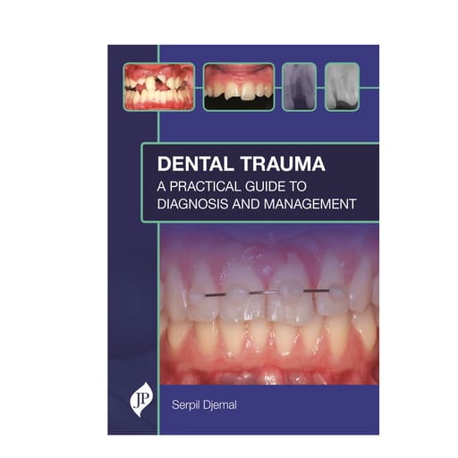 Jaypee Medical Dental Trauma: A Practical Guide to Diagnosis and Management (ISBN - 836662)