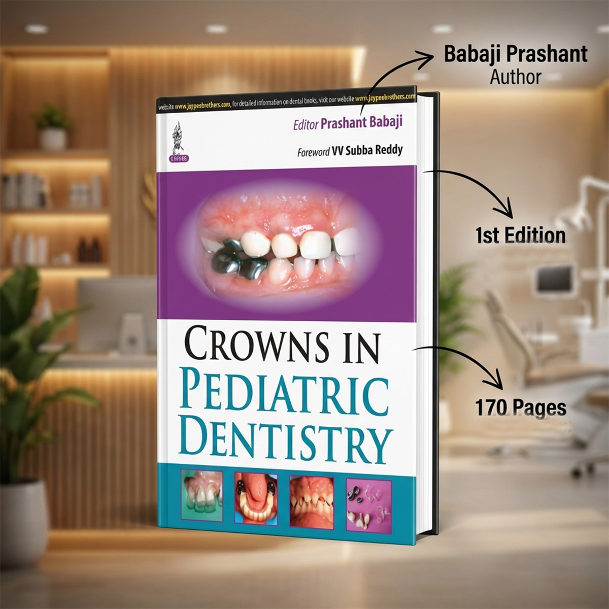 Jaypee Medical Crowns in Pediatric Dentistry (ISBN - 524397)