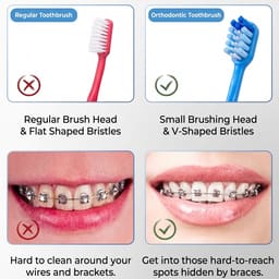 MyOra C-Soft Orthodontic Toothbrush (Pack Of 12) - 6