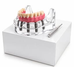 Julldent Overdenture Implant Model with 6 Implants (JULL-DENT 202) - 2