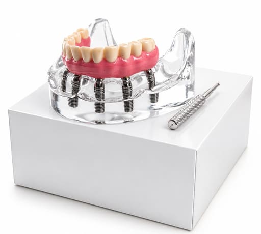 Julldent Overdenture Implant Model with 6 Implants (JULL-DENT 202)