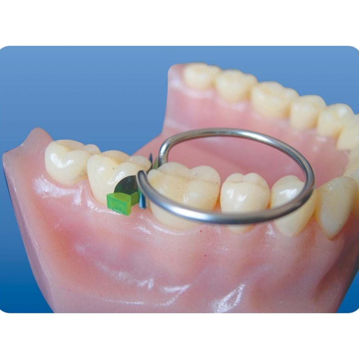 Tor Vm Sectional Contoured Metal Matrices - Advanced Kit No 1.298