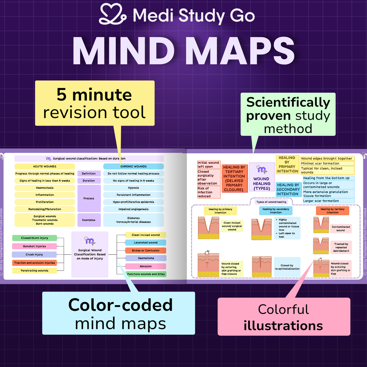 Medi Study Go General Surgery Mind Maps and Notes (ISBN: 257748)