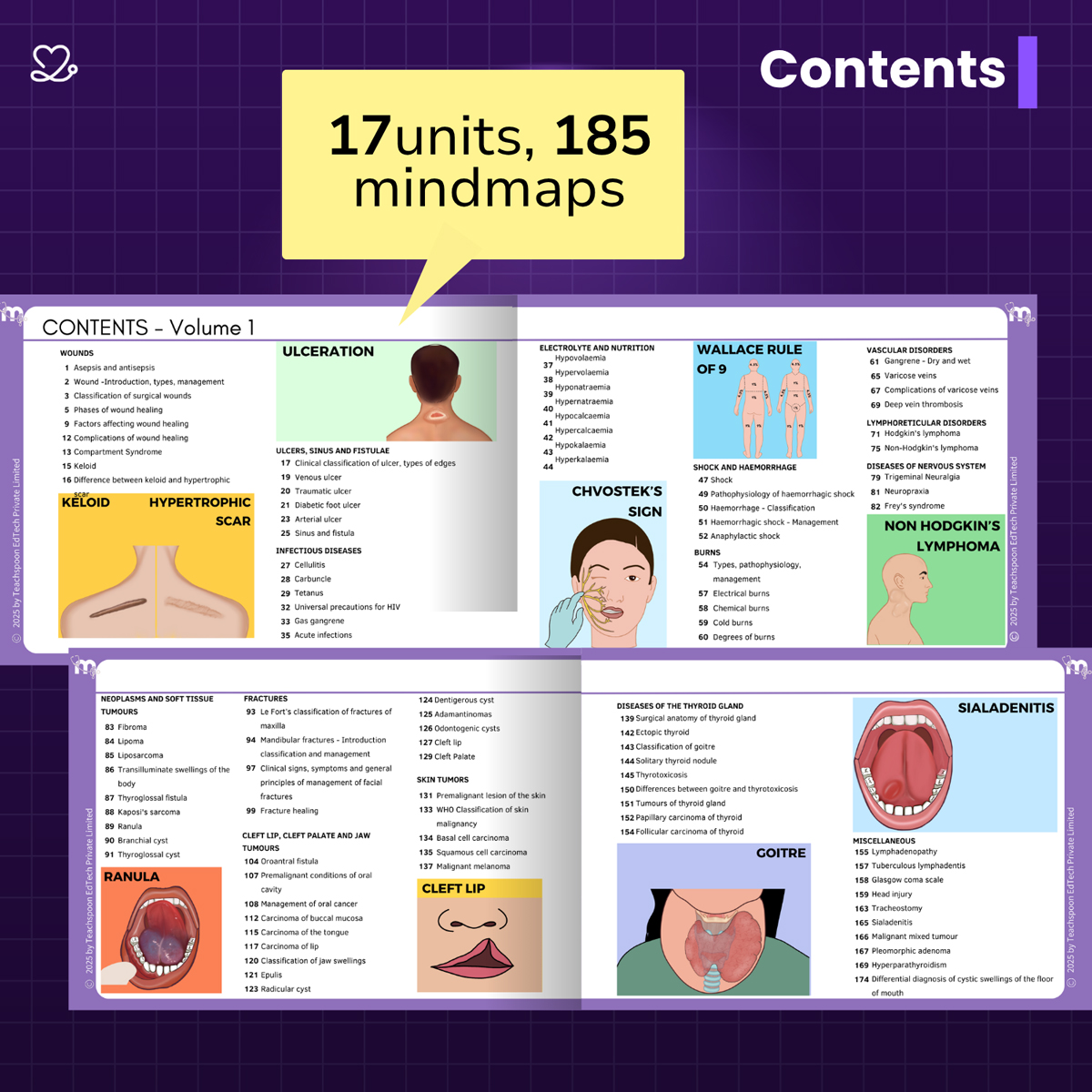 Medi Study Go General Surgery Mind Maps and Notes (ISBN: 257748)