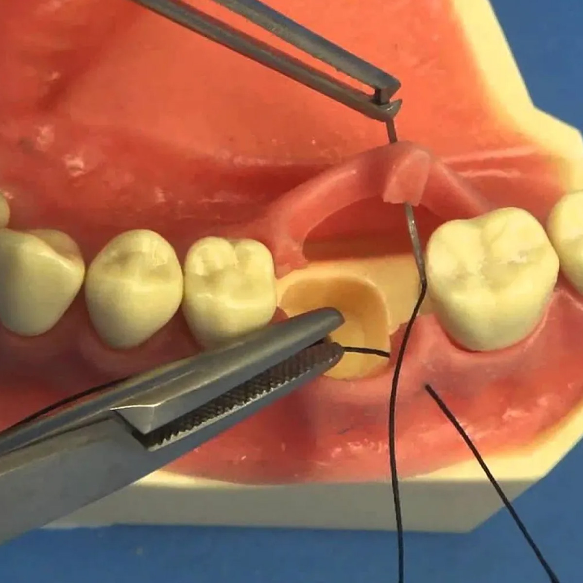 Meril Filasilk Black Braided Silk Suture Reel #3-0 (SLK30 822R) - 25Mtr