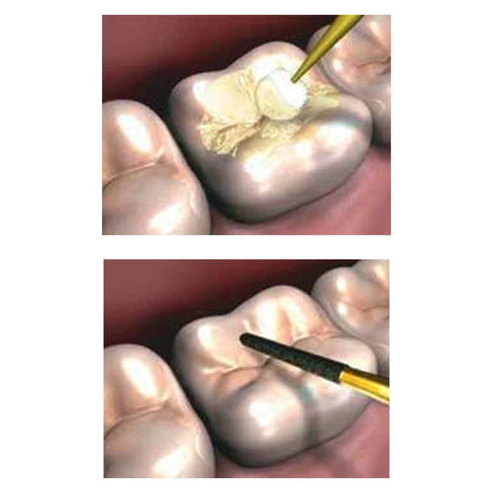 GC G-Coat Plus Protective Coating