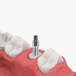 DentalPlant Alpha Bio ATI IH | ATID IH |ICE IH|NEO IH |SPI IH Compatible SmartPeg - 4