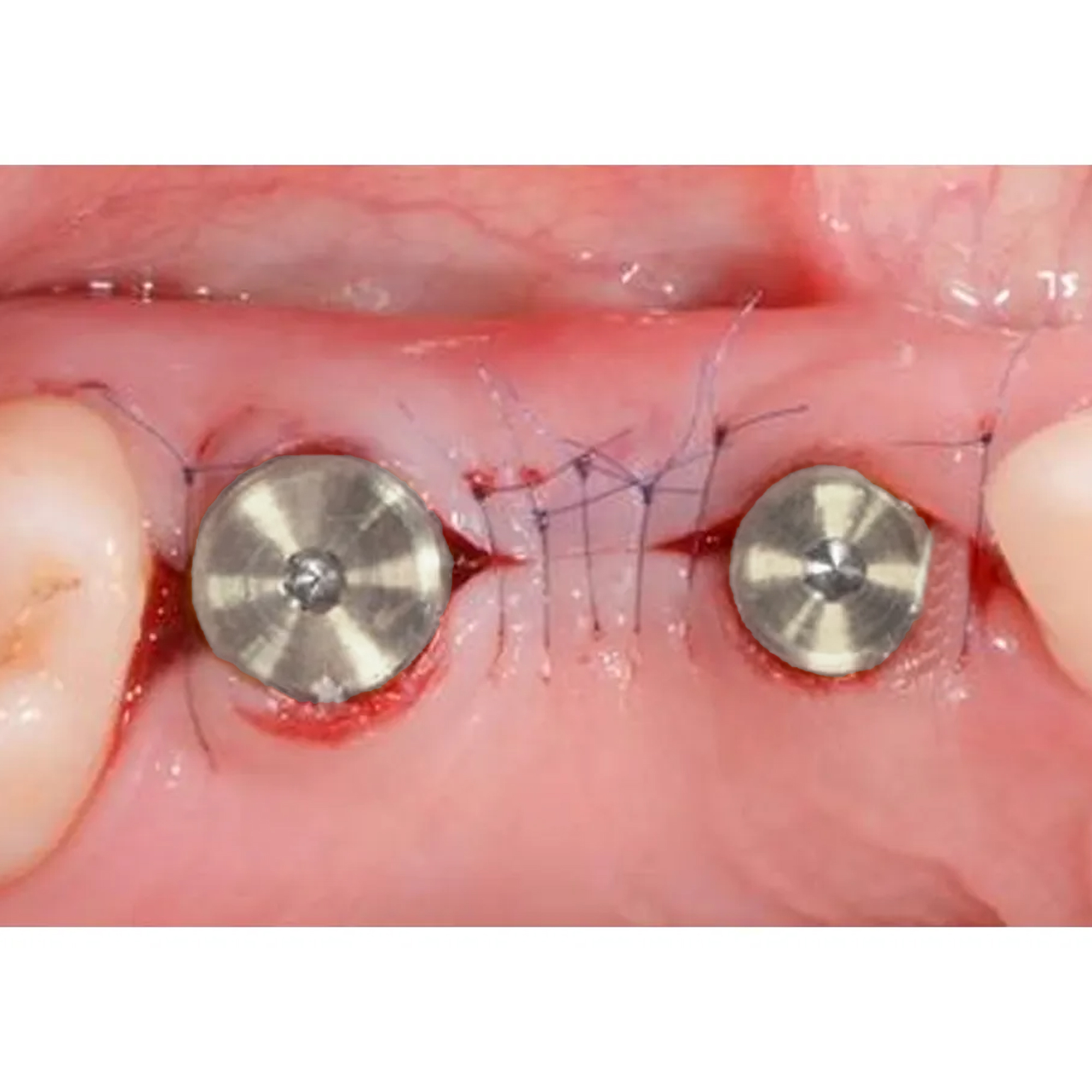 Dental