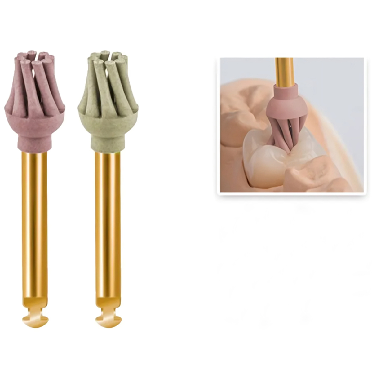 Youdent Diamond Polishing Kit For Composite (DRO804)