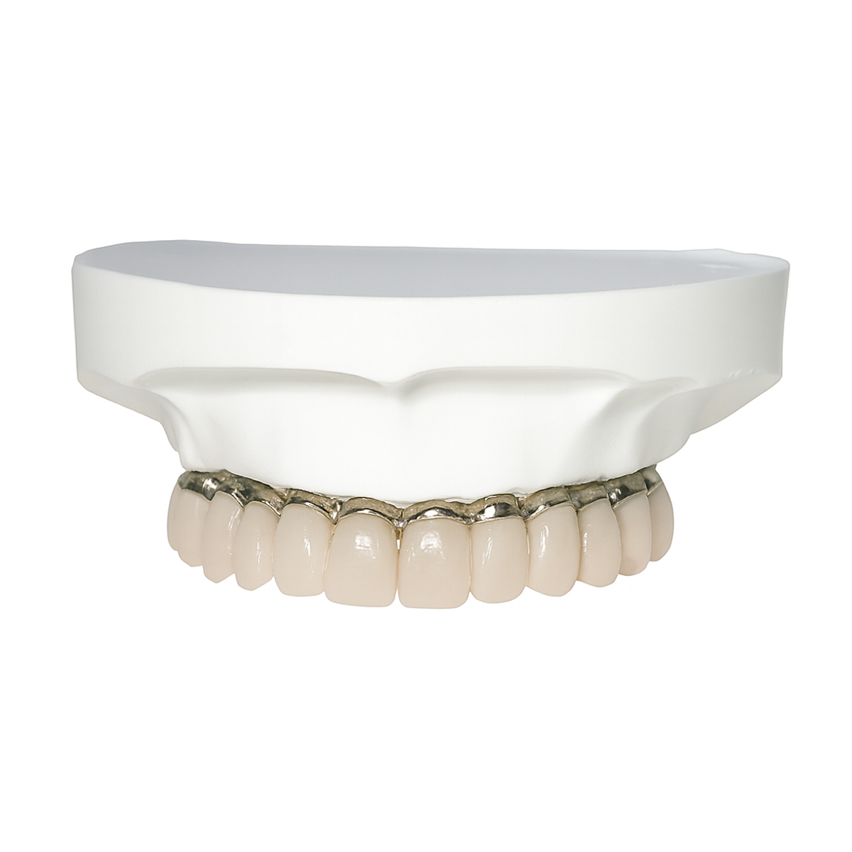 iDENTical All-On-4 Overdenture Model M6023